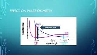 The Effect of Methylene Blue on Pulse Oximetry by Lauren Estes, MD Candidate Class of 2023