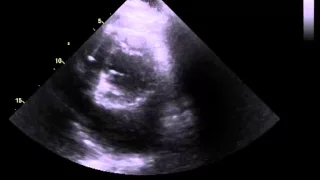 SonoSim Ultrasound Video Challenge - Cardiology