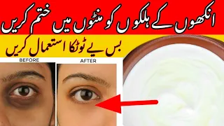 How to remove Dark circles at home | Live Results in 3 days | apply this magic remedy & get perfect