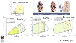 Understanding the Basics of Mechanical Circulatory Support