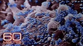 Chasing the bird flu | 60 Minutes Archive