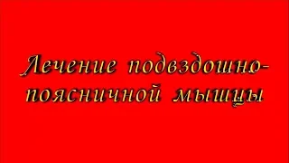 Лечение подвздошно-поясничной мышцы. Триггерная болезнь ППМ.