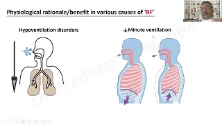 NIV in Respiratory Failure (RF) ~ Pro debate