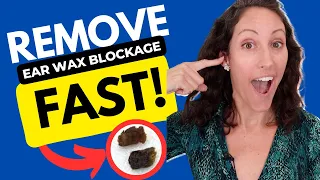 How to Remove Ear Wax Blockage Fast | DIY Ear Drop Recipe (FREE)