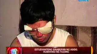 24 Oras: Estudyanteng sinabuyan ng asido, humihingi ng tulong