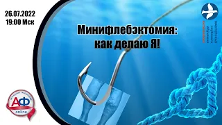 Минифлебэктомия: как делаю я!