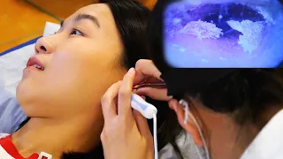 World's Greatest Ear Cleaning - ASMR