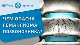 Гемангиома позвоночника