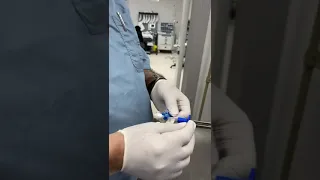 modified technique to get epidural space by loss of resistance to saline