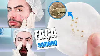 LIMPEZA DE PELE CASEIRA com POUCOS PRODUTOS | RESULTADO SURPREENDENTE