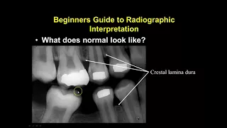 Radiographic Interpretation Section 1