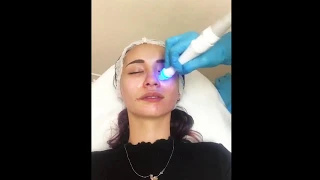 A Closer Look at Our Aquapure Facial!