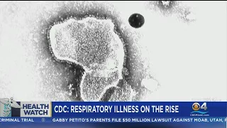 Health Watch: Respiratory illnesses on the rise