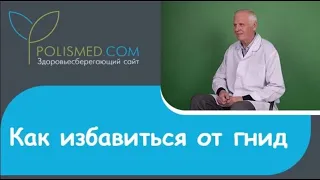 Как избавиться от гнид: обработка головы, вычесывание, средства, шампуни