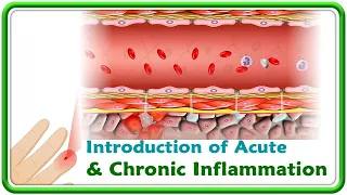 1. Introduction of Acute and Chronic Inflammation
