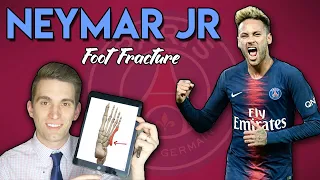 Neymar Jr Metatarsal Foot Injury | Doctor Explains Foot Fractures