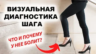 Как по походке найти нарушения? Разбор пациента на семинаре Глеба Кирдогло.