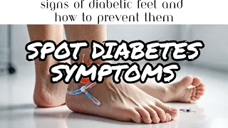 Beware! 5 TOP SECRET Signs of Diabetic Feet Revealed! [Emergency Alert]