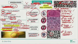 Hematología - Linfoma de hodgkin   linfoma no hosgkin   mieloma multiple   sindrome de lisis tumoral