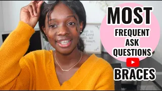 MOST FREQUENT ASKED QUESTIONS| BRACES!| Danise Life