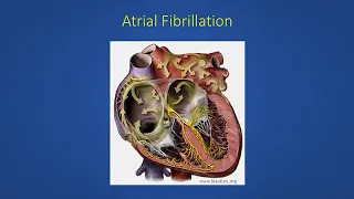 Normal, Skipped, or Irregular Heart Beats