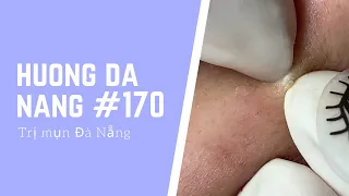 #170 | Huong Da Nang