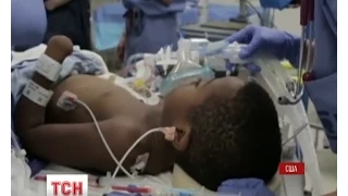 У США восьмирічному хлопчику вперше у світі пересадили одразу дві руки