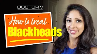 How To Treat Blackheads | Skin Of Colour | Brown Or Black Skin - Doctor V