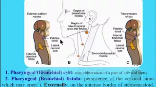 11 Anomalies of the pharyngeal apparatus