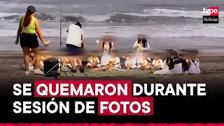 Lurín: niños de inicial sufren graves quemaduras durante sesión de fotos en la playa