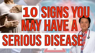 10 Warning Signs You May Have a Serious Disease - By Dr. Willie Ong (Internist and Cardiologist)