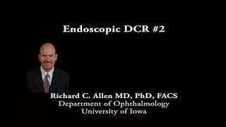 Endoscopic dacryocystorhinostomy DCR #2