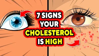 7 Early Symptoms Of High LDL Cholesterol