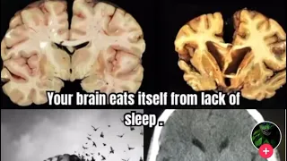 Do Not Let Your Brain “Eat” Itself… 😰