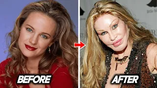 Actors from The Young and the Restless actors who got plastic surgery