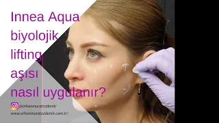 Innea Aqua Biolojik Lifting Aşısı nasıl uygulanır? [6 nokta lifting aşısı nedir?]