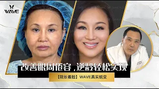 【真实案例】年过58？数次整形失败？但最后还是整成了温碧霞！