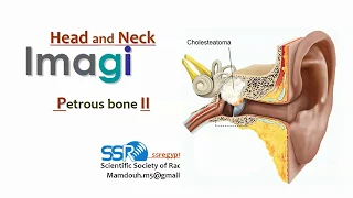 6 Petrous Bone ( part 2) - prof.Mamdouh Mahfouz (2019 edition)