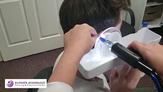 EARWAX Removal- Painless Earwax Removal using the EARIGATOR