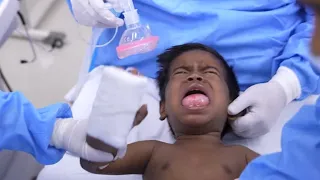 Little Boy with Ranula Cyst Crying & Scared Before Anesthesia