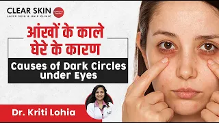 Periorbital Hyperpigmentation:आंखों के काले घेरे के कारण | Eye Dark Circles - Part 1| ClearSkin Pune