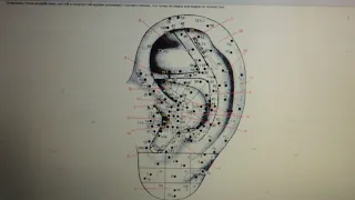 Состояние здоровья отражено на ушной раковине.Аурикулодиагностика.