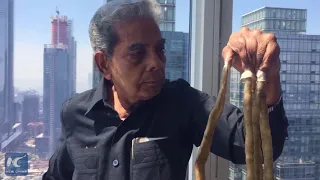 Man with world’s longest fingernails cuts them off after 66 years