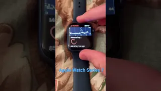 Проверяем пульс у кровати с помощью Apple Watch Series 7 в 2022 году