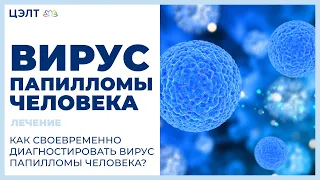 Вирус папилломы человека лечение. 😟 Как своевременно  диагностировать вирус папилломы человека?