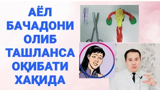 АЁЛНИ БАЧАДОНИ ( МАТКА ) ОЛИБ ТАШЛАНСА НИМА БЎЛАДИ | НЕГА АЁЛ МАТКАСИДАН АЙРИЛАДИ/ АСОРАТИ НИМА