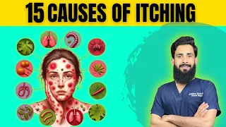 خارش کی پندرہ غیر معمولی وجوہات | 15 causes of ITCHING you have never heard about|