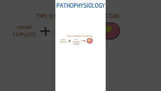 SYSTEMIC LUPUS ERYTHEMATOSUS | Pathophysiology