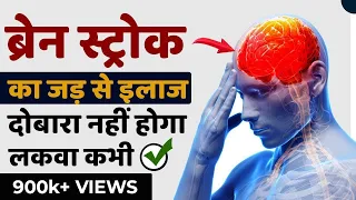 ब्रेन स्ट्रोक का जड़ से इलाज | दोबारा नहीं होगा लकवा कभी | Brain Stroke Treatment | Lakwa Ka Ilaj