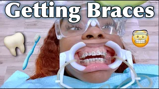 VLOG | GETTING BRACES FOR THE 1ST TIME | BRACES KIT + COOKING + LYMPHATIC MASSAGE + FAMILY REACTION